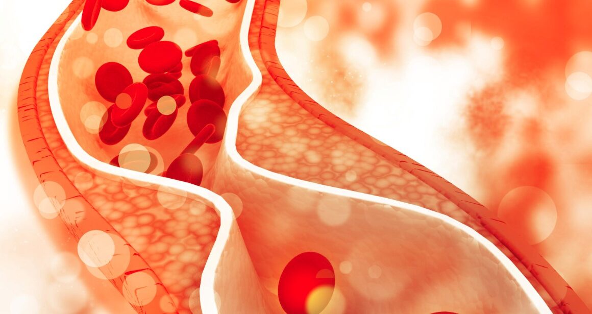 हाथ-पैर और आंखों के ये बदलाव बता सकते हैं बढ़ता कोलेस्ट्रॉल