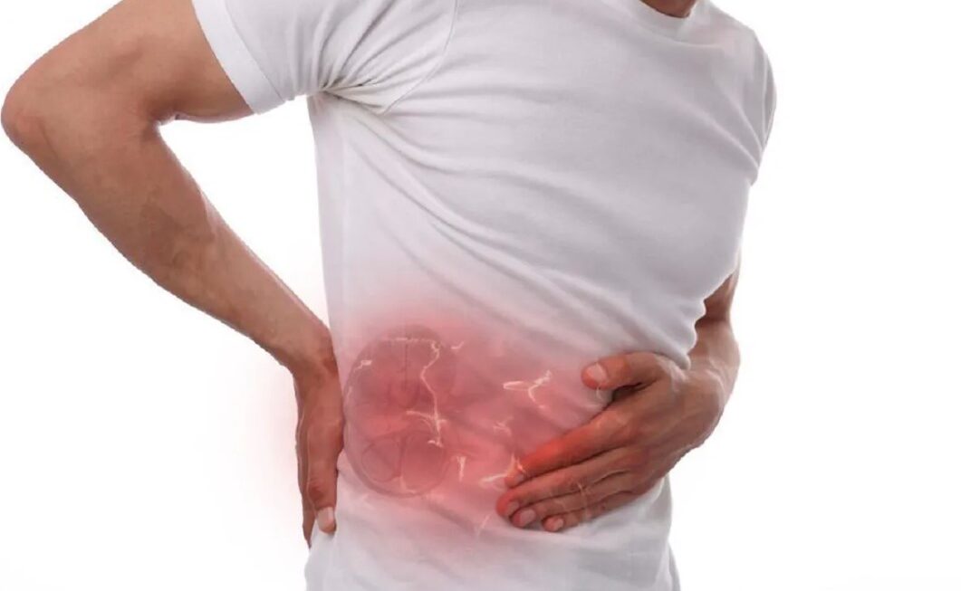 पीठ या पेट में दर्द हो तो न करें नजरंदाज? हो सकता है किडनी स्टोन का संकेत