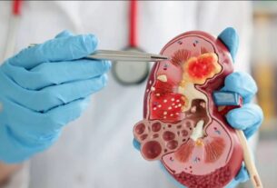 किडनी स्टोन को नजरअंदाज करना पड़ सकता है भारी, समय पर इलाज जरूरी